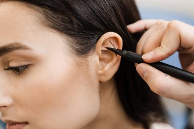 Cerrah otoplasti estetik ameliyatından önce kulağına işaret koymuş. Kulak ameliyatından önce göz kapağı ameliyatı. Pinna ve kulak cerrahi yeniden şekillendirme için Otoplasty işareti
