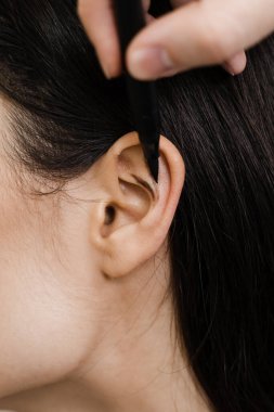Kulak ameliyatından önce göz kapağı ameliyatı. Cerrah otoplasti estetik ameliyatından önce kulağına işaret koymuş. Pinna ve kulak cerrahi yeniden şekillendirme için Otoplasty işareti