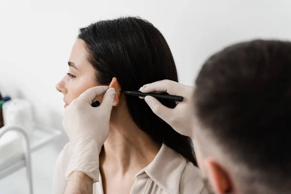 Otoplasty markup for surgical reshaping of the pinna, or outer ear for correcting an irregularity and improving appearance. Surgeon doctor marking girl ear before otoplasty cosmetic surgery