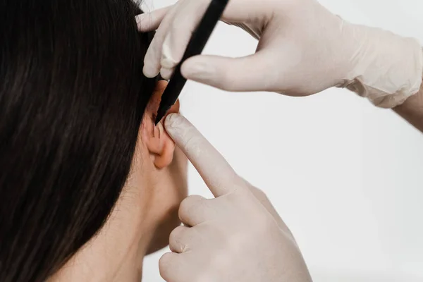 Pinna ve kulak cerrahi yeniden şekillendirme için Otoplasty işareti. Kulak ameliyatından önce göz kapağı ameliyatı. Cerrah otoplasti estetik ameliyatından önce kulağına işaret koymuş.