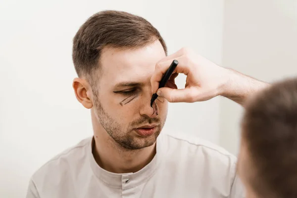 Zbliżenie Męskiej Plastyki Nosa Blepharoplastyka Oznakowaniem Usuwania Przepukliny Twarzy Przed — Zdjęcie stockowe