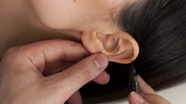 Video Vertical Otoplastie Markup Aproape Înainte Intervenția Chirurgicală Urechii Chirurgul — Videoclip de stoc
