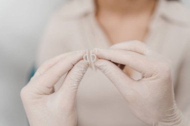 Burun kemiği septoplasti sırasında burun deformasyonunu düzeltmek için buruna sabitlenir. KBB doktoru burun debriyajı tutuyor. İki parça plastik burun içinde.