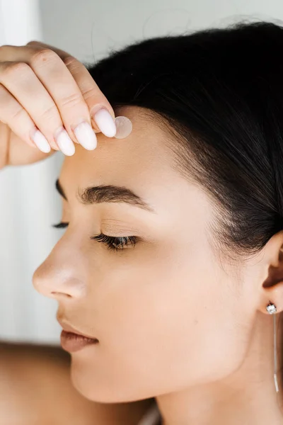 Sivilce ve rosacea tedavisi için sivilce bandı kullanan genç bir kadın. Yüz tazeleme, kozmetolojiyi temizleme. Sivilceli bir kız, yanağında yuvarlak sivilce bandı var.