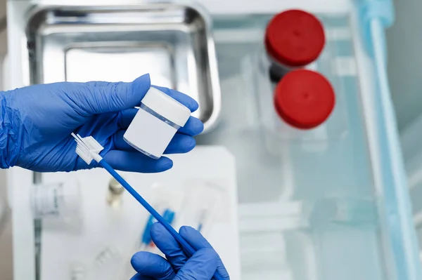 Jinekolog elinde sitoloji testi için matara tutuyor. Jinekolojik sitoloji. Pap smear testi ve sitofırça jinekoloğun ellerinde.