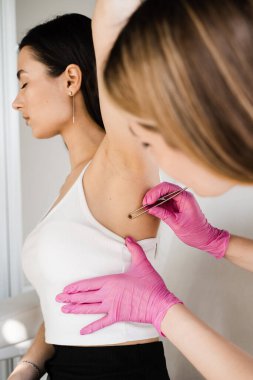 Deri neoplazması ve genç kadının lezyonları inceleniyor. İyi huylu köstebekleri kontrol ediyorum. Dermatolog, melanom ve deri kanseri intikamı için kızın benini ya da doğum lekesini inceliyor.