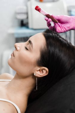 Deri hacmini ve dokusunu iyileştirmek için trombosit Rich Plasma PRP, gevşekliği ve ince kırışıklıkları azaltır. PRP zengin plazma prosedürü için hasta kız plazması içeren test tüplü kozmetolog.