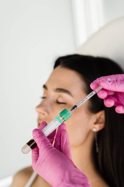 Deri hacmini ve dokusunu iyileştirmek için trombosit Rich Plasma PRP, gevşekliği ve ince kırışıklıkları azaltır. PRP zengin plazma prosedürü için hasta kız plazması içeren test tüplü kozmetolog.