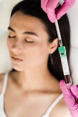 Deri hacmini ve dokusunu iyileştirmek için trombosit Rich Plasma PRP, gevşekliği ve ince kırışıklıkları azaltır. PRP zengin plazma prosedürü için hasta kız plazması içeren test tüplü kozmetolog.