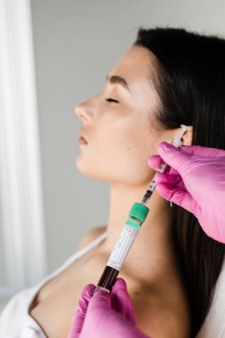 Deri hacmini ve dokusunu iyileştirmek için trombosit Rich Plasma PRP, gevşekliği ve ince kırışıklıkları azaltır. PRP zengin plazma prosedürü için hasta kız plazması içeren test tüplü kozmetolog.