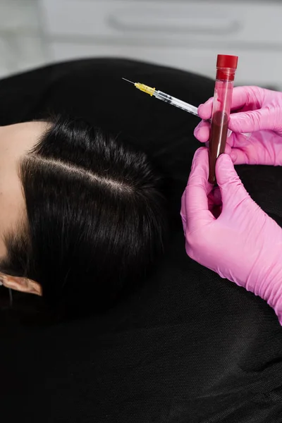 Platelet Rich Plasma PRP for improves skin volume and texture, reduces flaccidity and fine wrinkles. Cosmetologist with test tube with plasma of patient girl for PRP Platelet Rich Plasma procedure
