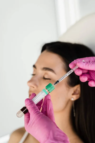 Platelet Rich Plasma PRP for improves skin volume and texture, reduces flaccidity and fine wrinkles. Cosmetologist with test tube with plasma of patient girl for PRP Platelet Rich Plasma procedure