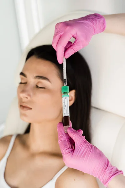 Cosmetologist with test tube with blood and plasma for PRP Platelet Rich Plasma procedure. Platelet Rich Plasma PRP for improves skin volume and texture, reduces flaccidity and fine wrinkles
