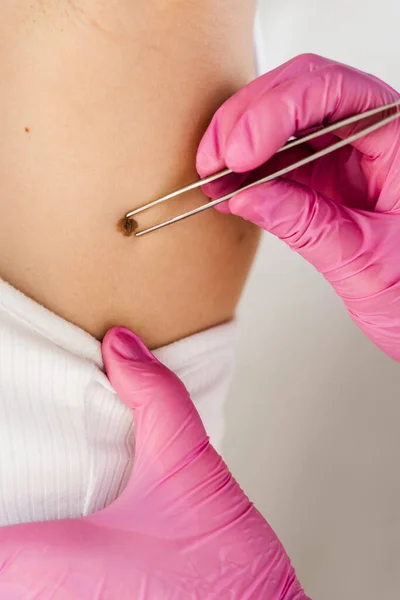 Dermatologist Examines Moles Birthmark Girl Patient Revention Melanoma Skin Cancer Royalty Free Stock Photos