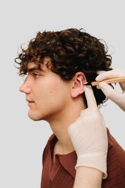 KBB doktoru estetik ameliyattan önce kulakları yeniden şekillendirmek için çizgiler çiziyor. Otoplasty ameliyat işareti kulak