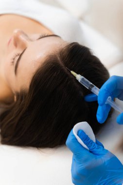 Kozmetik kliniğinde kafa derisi kılı için mezoterapi. Özel ilaç kullanılarak saç büyümesini iyileştirmek için Mezoterapi enjeksiyon süreci