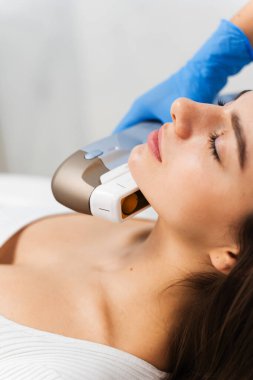 İğnesiz rf-lift işlemi. Özel kozmetoloji aygıtının yardımıyla yüz gerdirme