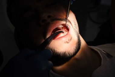 Diş muayenesi. Diş aynası ve kâşifi olan dişçi hasta dişlerini muayene ediyor. Profesyonel diş hijyenine hazırlık