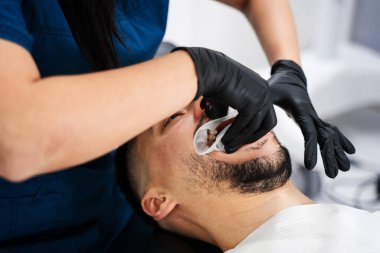 Dudak retraktörü, stomatoloji prosedürlerinden önce kurulmuş. Diş hekimi dudak retraktörü diş izolasyonu ürünü uygular