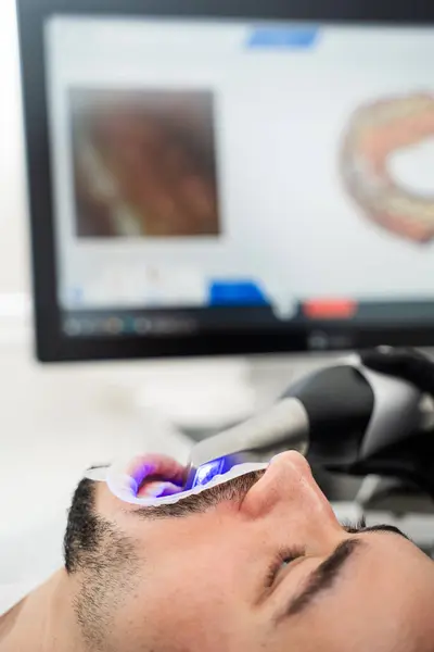 stock image Dental 3d scanner applying process. Digital impressioning teeth of patient with 3d digital dental scanner