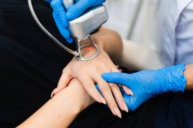 Lazer el işlemindeki yaraları siler. Kozmetoloji kliniğindeki kadına karbondioksit yüzeyi lazeri uygulamak