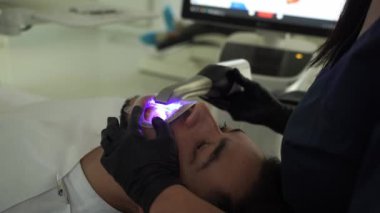 3D dijital diş tarayıcısı olan bir hastanın dijital baskı dişleri. Dişçi 3d tarayıcısı 4k video uygulaması