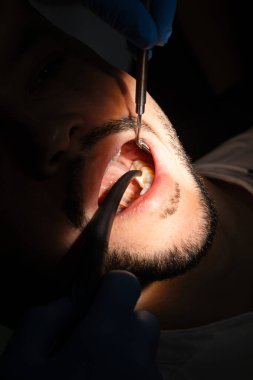 Profesyonel diş hijyenine hazırlık. Diş muayenesi. Diş aynası ve kâşifi olan dişçi hasta dişlerini muayene ediyor.