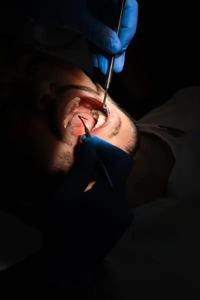 stock image Dental checkup. Dentist with dental mirror and explorer examine patient teeth. Preparation to professional dental hygiene.