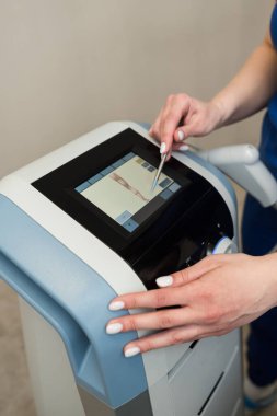 SIS 'in kırıkları ameliyat etmeden iyileştirmesi için ayarlar yapılıyor. Süper tümevarımsal sistem dikey fotoğrafının kontrol ekranı