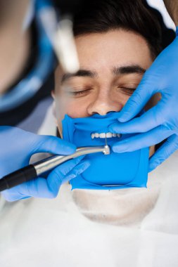 Diş tedavisine başvuran bir kaktüs. Doktor dişleri kaplama kurulumuna hazırlamak için diş matkabı ve cofferdam kullanır.