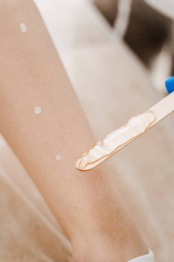 Doğum lekelerini saklamak ve güvenli ve acısız bir lazer epilasyonu için jel almak. Bölgeyi serinletmek ve kayganlaştırmak için lazer kılı çıkarmadan önce bacaklara özel jel sürüyorum.