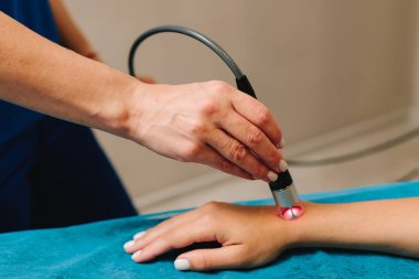 Ağrı, uyuşukluk ve karıncalanma için ellerin kızılötesi tedavisi. Kan akışını ve bağışıklık sistemini geliştirmek için lazer terapisi yapıyorum. Yumuşak dokuların iyileşmesini sağlamak için düşük seviye lazer tedavisi.