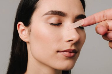 Burun estetiği. Şeklini korumak için burun üstüne bandaj uygulamak, şişliği azaltmak ve görünümü iyileştirmek. Estetik cerrah burun üstüne burun bandı takıyor.