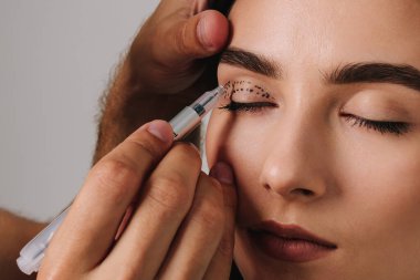 Plastik cerrah üst blefaroplasti için kontur belirliyor. Doğru yüz gerdirme için göz kapaklarının derisini çizmek ve fazla deriyi çıkarmak için güvenli bir ameliyat.