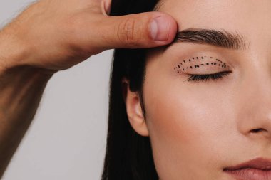 Blepharoplasty işareti. Göz kapaklarını kusursuz bir planla kaldırmak. Doktor üst göz kapağı ameliyatı için tıbbi işaretli bir plan hazırlıyor.
