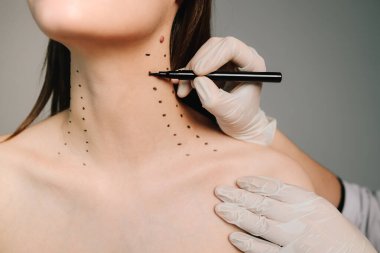 Nefertiti kaldırmadan önce işaretle. Kozmetik uzmanı bir kadının platizmasına botulinyum toksin enjekte edilmeden önce nokta çiziyor. Bir profesyonelden boyun geliştirme. Kadın estetik kozmetolojisi