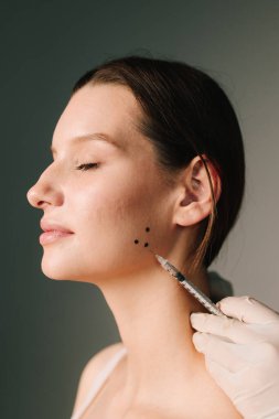 Bir kozmetikçi tarafından diş gıcırdatma için Bruksizm damgası. Bir estetik tıp kliniğinde botulinyum toksinle tedavi için Bruksizm yüz işaretleme