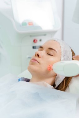 Dermatolog tarafından yapılan lazer tedavisi. Güzellik kliniğinde acısız rosacea tedavisi. Hasta yüzünde IPL ultrason lazeriyle açılmış küçük damarların çıkarılması.