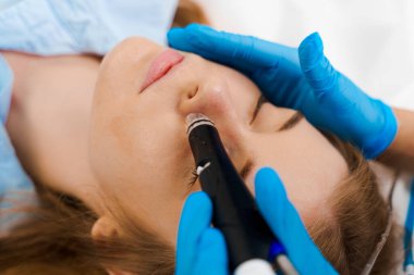 Bir kadın için yüz hidrosiyali cilt temizleme ameliyatı yapan bir güzellik uzmanı. Klinikte acısız yüz temizleme. Güzellik merkezinde tıbbi aletle Hidroseksüel Temizleme Prosedürü