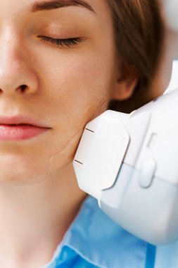 Dermatoloji kliniğinde kadının yüzünde IPL lazer akne tedavisi. IPL ultrason lazer cihazıyla elmacık kemiklerinde sivilce tedavisi yapıyorum. Lazer cilt prosedürü