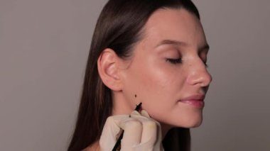 Bir kozmetik uzmanı tarafından diş gıcırdatma videosu için Bruksizm işaretlemesi. Bir estetik tıp kliniğinde botulinyum toksinle tedavi için Bruksizm yüz işaretleme