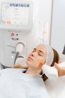 Dermatolog tarafından yapılan IPL lazer tedavisi. Güzellik kliniğinde acısız rosacea tedavisi. Hasta yüzünde IPL ultrason lazeriyle açılmış küçük damarların çıkarılması.