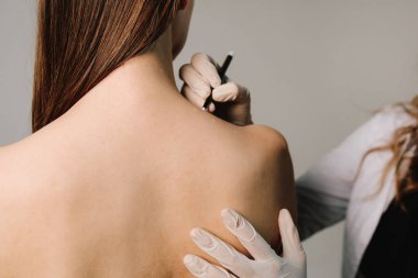 Migrenden kalma deri ve terapi için ağrı kesici. Yüksek kaliteli bir uzman tarafından acısız tedavi. Doktor, migren tedavisi için sırt derisine işaretler çizer.