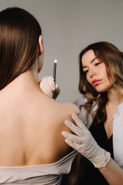 Doktor, migren tedavisi için sırt derisine işaretler çizer. Migrenden kalma deri ve terapi için ağrı kesici. Yüksek kaliteli uzman tarafından acısız tedavi