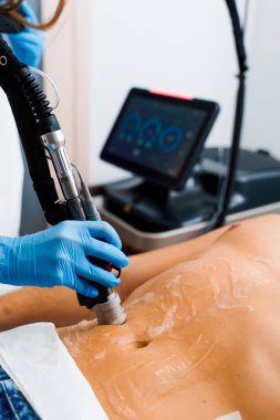 Ultrason lazer teçhizatıyla vücutta insan tüyü çıkarma işlemi. Güzellik merkezinde lazer cihazı olan bir adama mide epilasyonu yaptırmak.