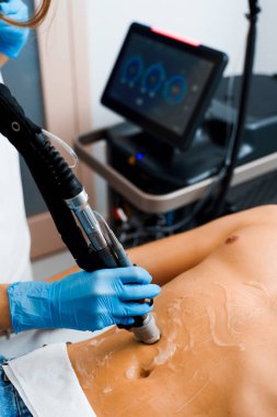 Güzellik merkezinde lazer cihazı olan bir adama mide epilasyonu yaptırmak. Ultrason lazer teçhizatıyla vücuttaki kılların alınması işlemi