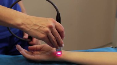 Yumuşak dokuların iyileşmesini desteklemek için düşük seviyeli lazer tedavisi. 4K video. Ağrı, uyuşukluk ve karıncalanma için ellerin kızılötesi tedavisi. Kan akışını ve bağışıklık sistemini geliştirmek için lazer tedavisi
