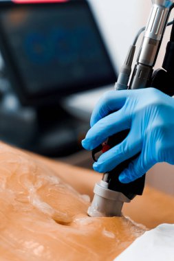 Güzellik merkezinde lazer cihazı olan bir adama mide epilasyonu yaptırmak. Ultrason lazer teçhizatıyla vücuttaki kılların alınması işlemi