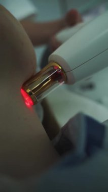 IPL ekipmanlı Rosacea lazer tedavisi, güzellik uzmanı 4K video. Hasta yüzündeki küçük damarların lazer teçhizatla çıkarılması.