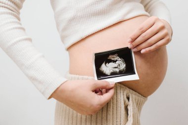 Mutlu hamile anne ultrason görüntüsünü ultrasondan sonra gösterir. Hamileyken karnında doğmamış bebeğin ultrasonu var.